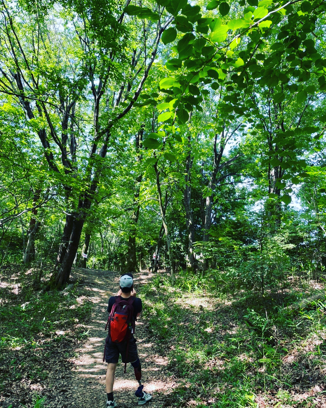 バイオニック義足の価格はいくらですか?